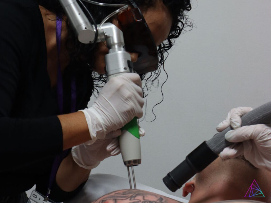 Astanza Community Laser Tattoo Removal Day