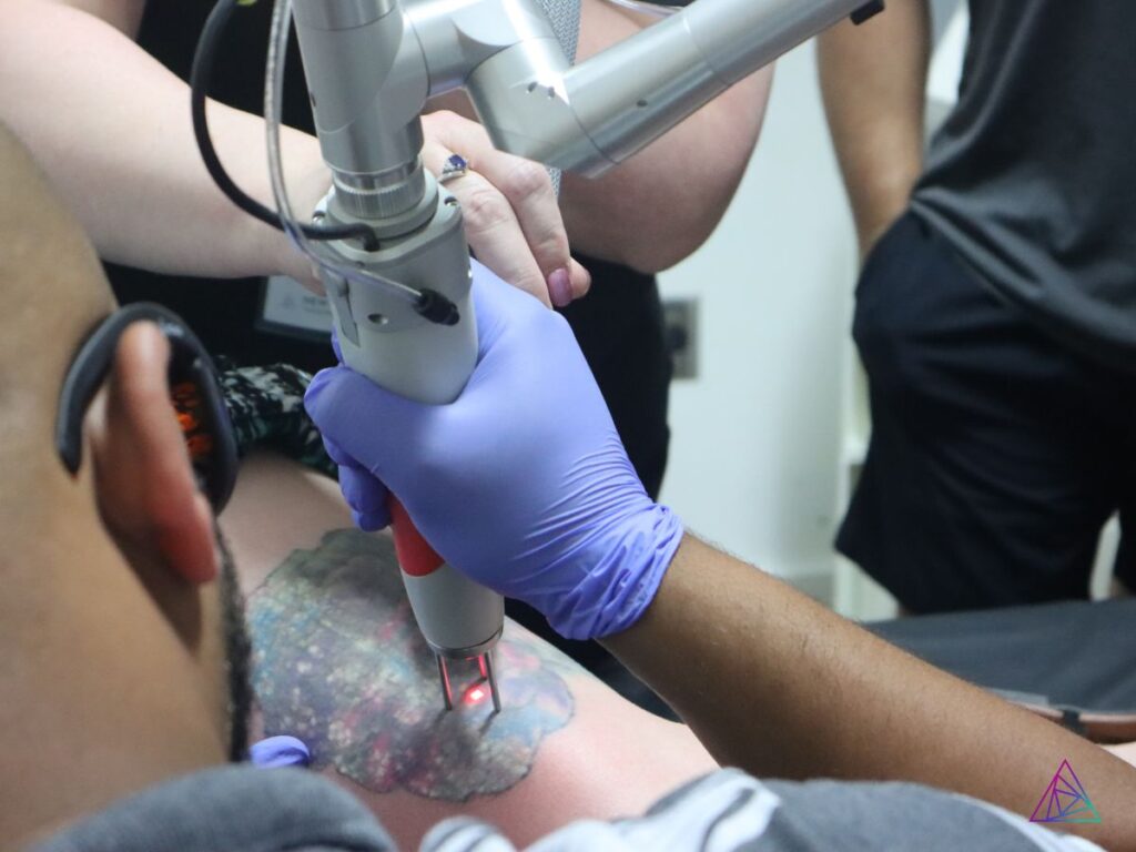 on-demand-webinar-FAQs-about-starting-a-laser-tattoo-removal-business