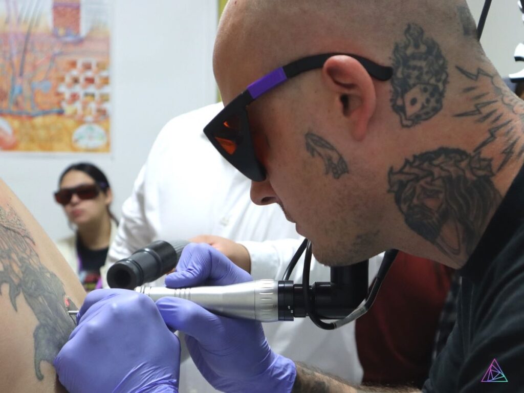astanza tattoo removal news episode 11 season 1