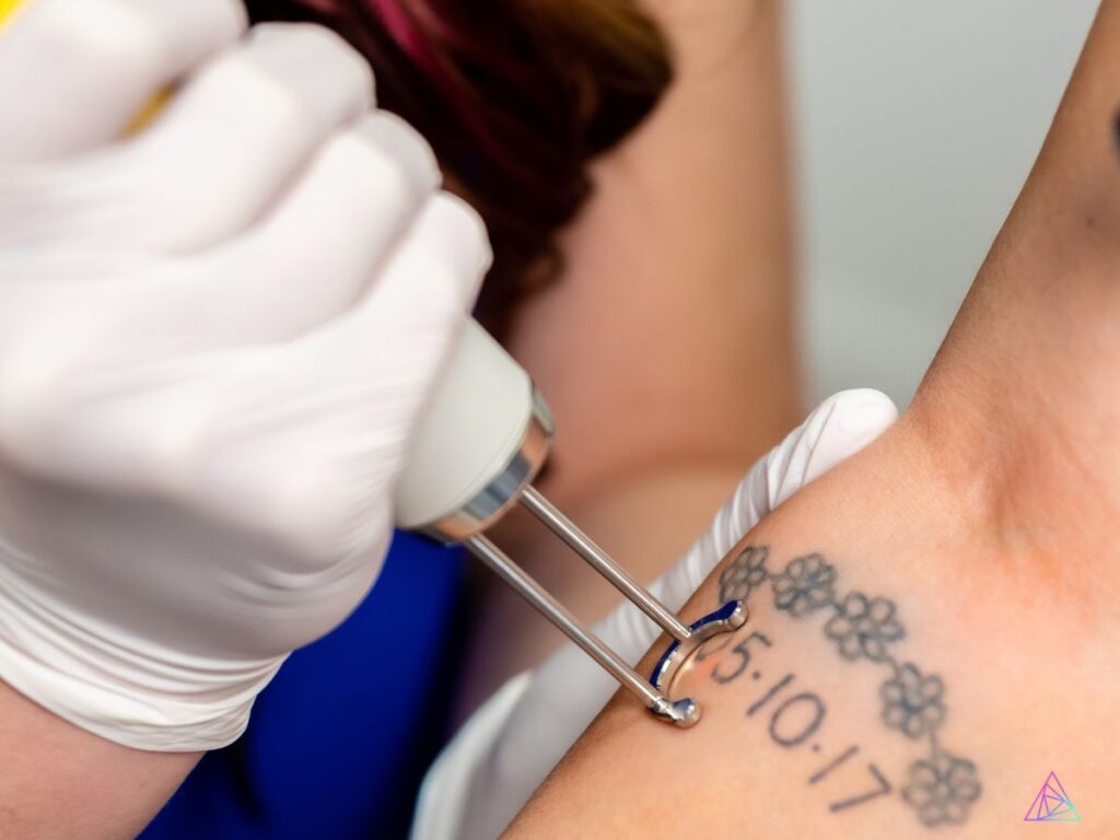 Celebrate-National-Tattoo-Removal-Day-Aug-14-2023