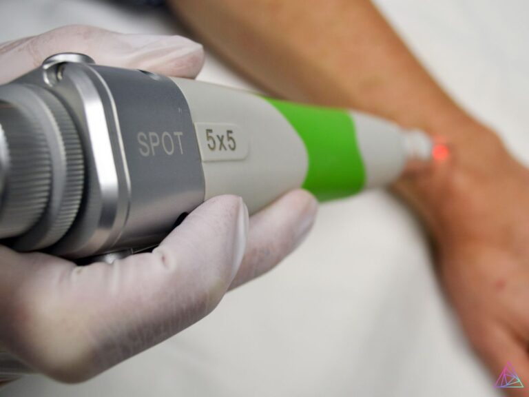 pigmented lesion laser removal