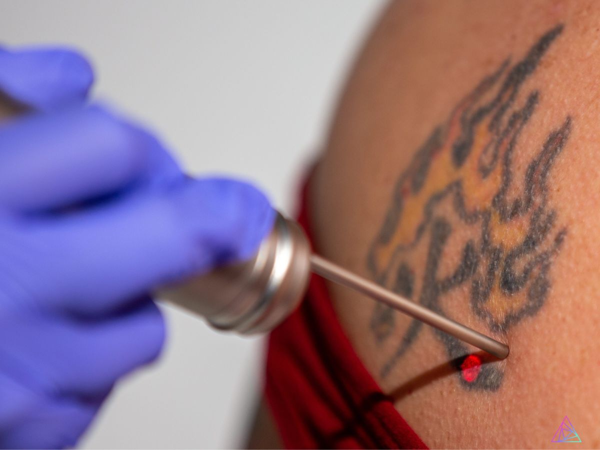 Tattoo-Artists-and-Tattoo-Removal-Better-Together-Webinar