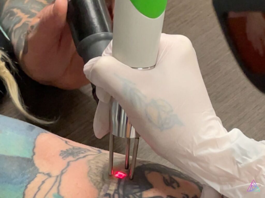 celebrate national tattoo removal day