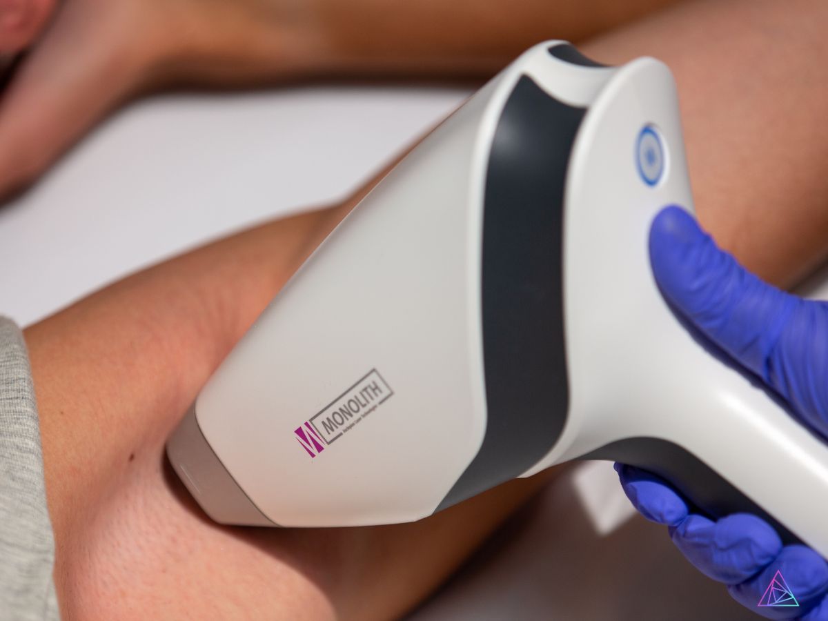 diode hair removal lasers