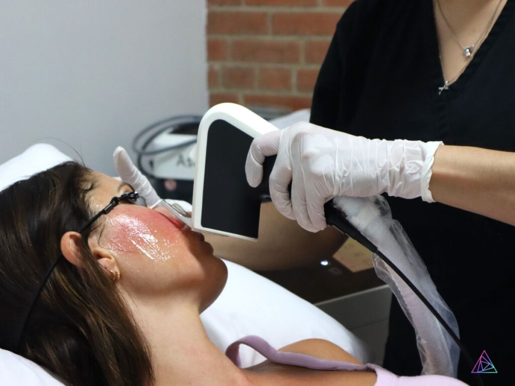Treating-Pigmentation-Concerns-with-Medical-Grade-Lasers