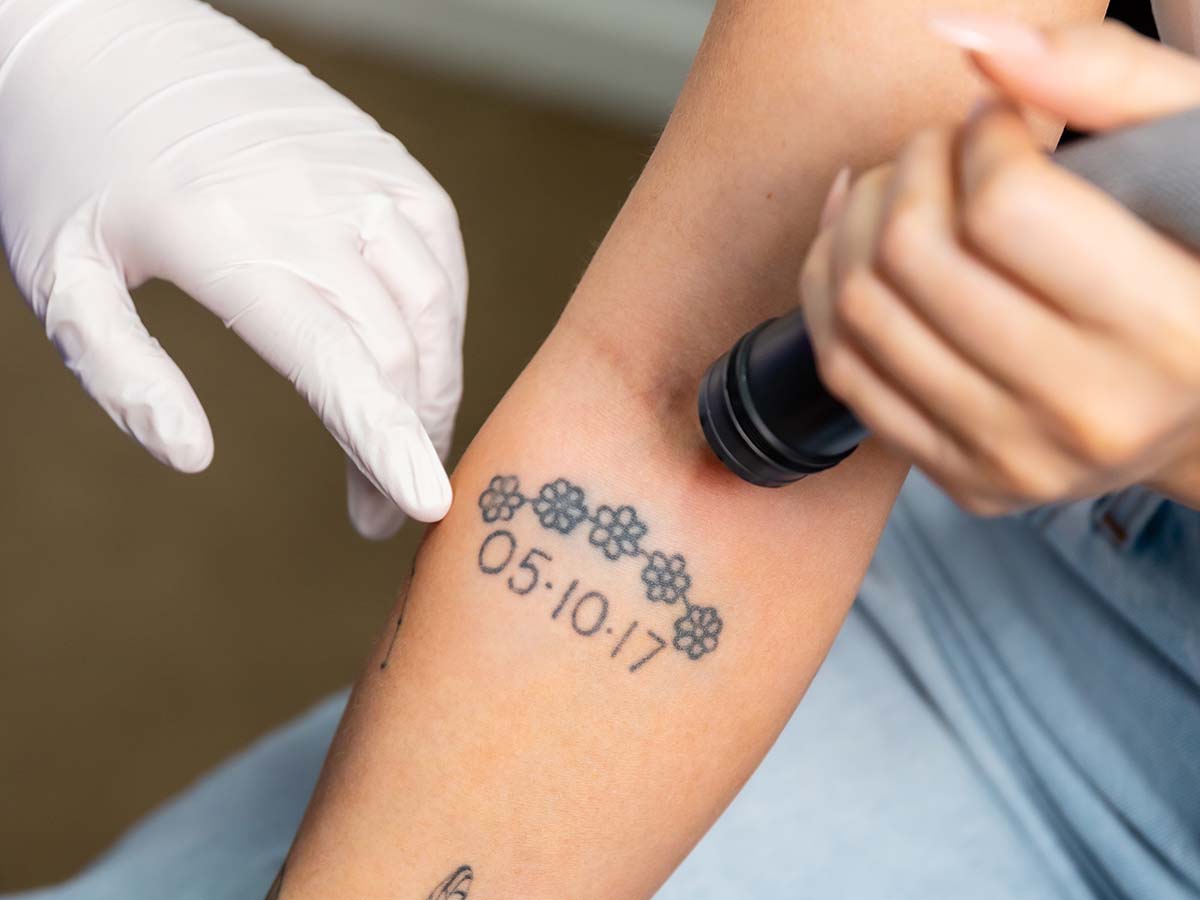 Tattoo Removal - flowers and date