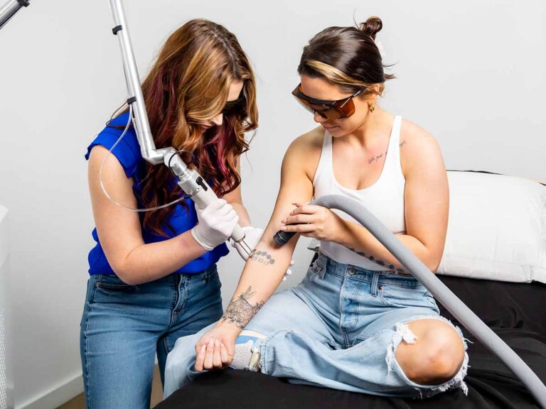 Astanza Laser Treatment