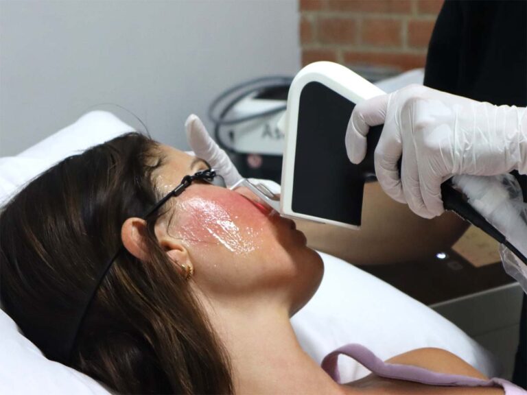 Pigmentation Patient Pic