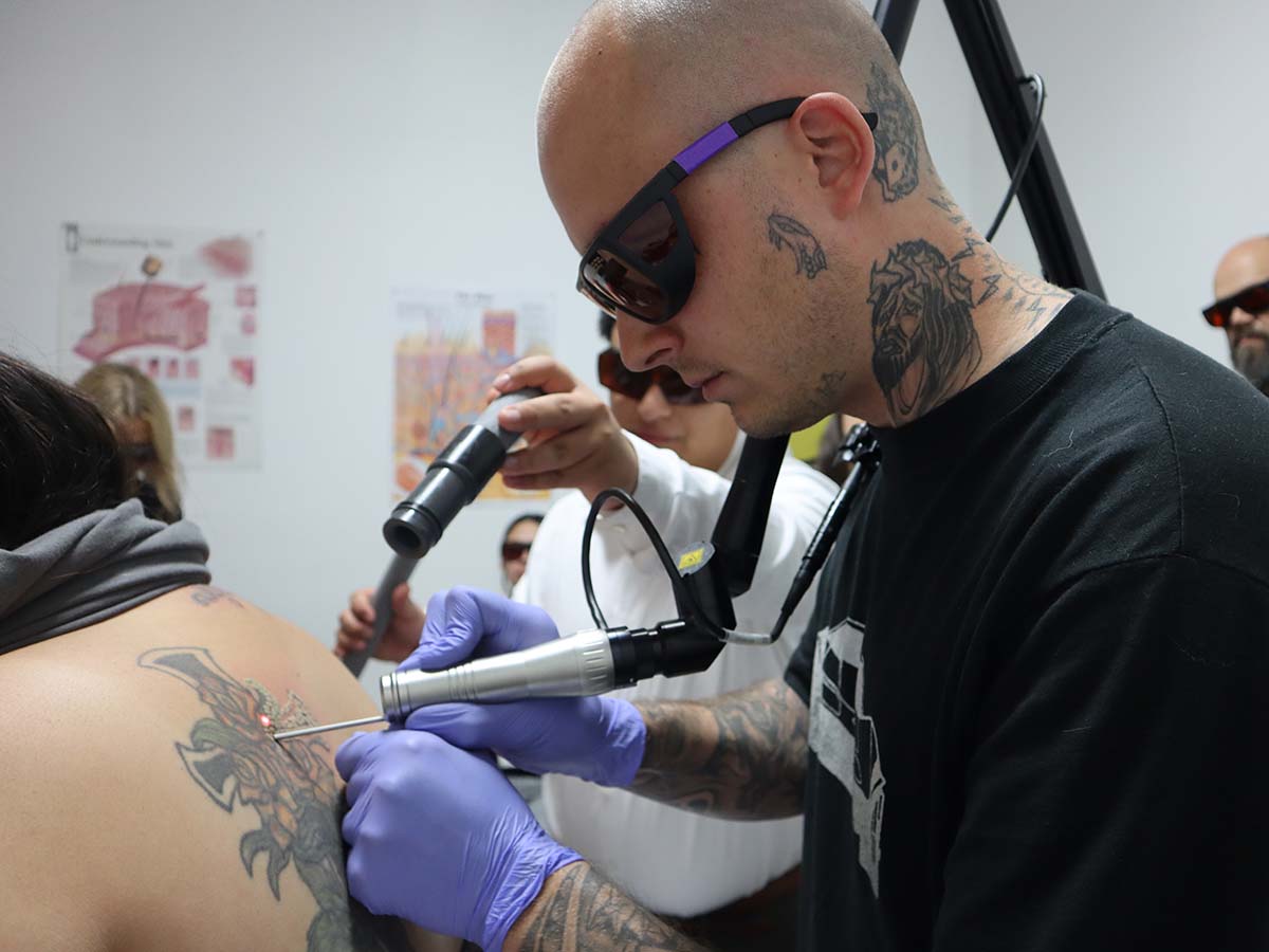 Expert Laser Tattoo Removal Services in Seattle & Des Moines, WA - Allen  Medical Aesthetics