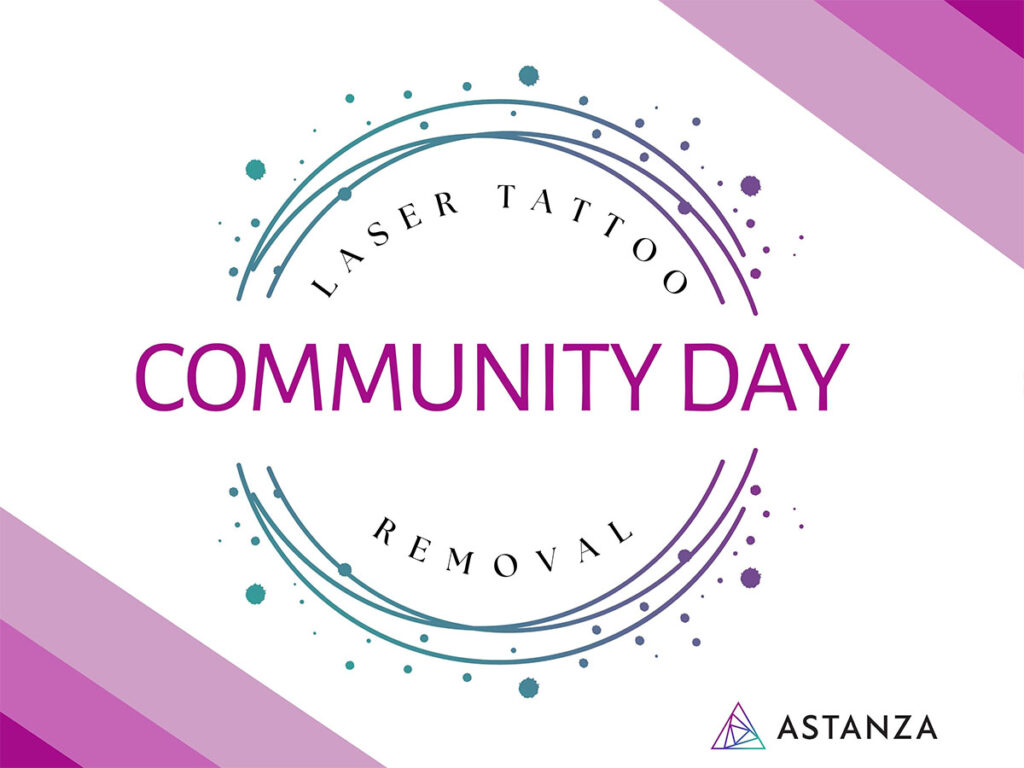 Community Day Laser Tattoo Removal