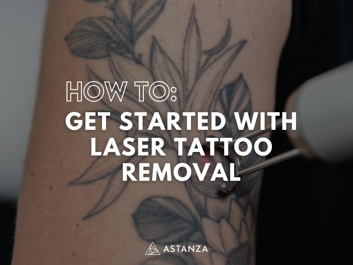 how to get started with laser tattoo removal