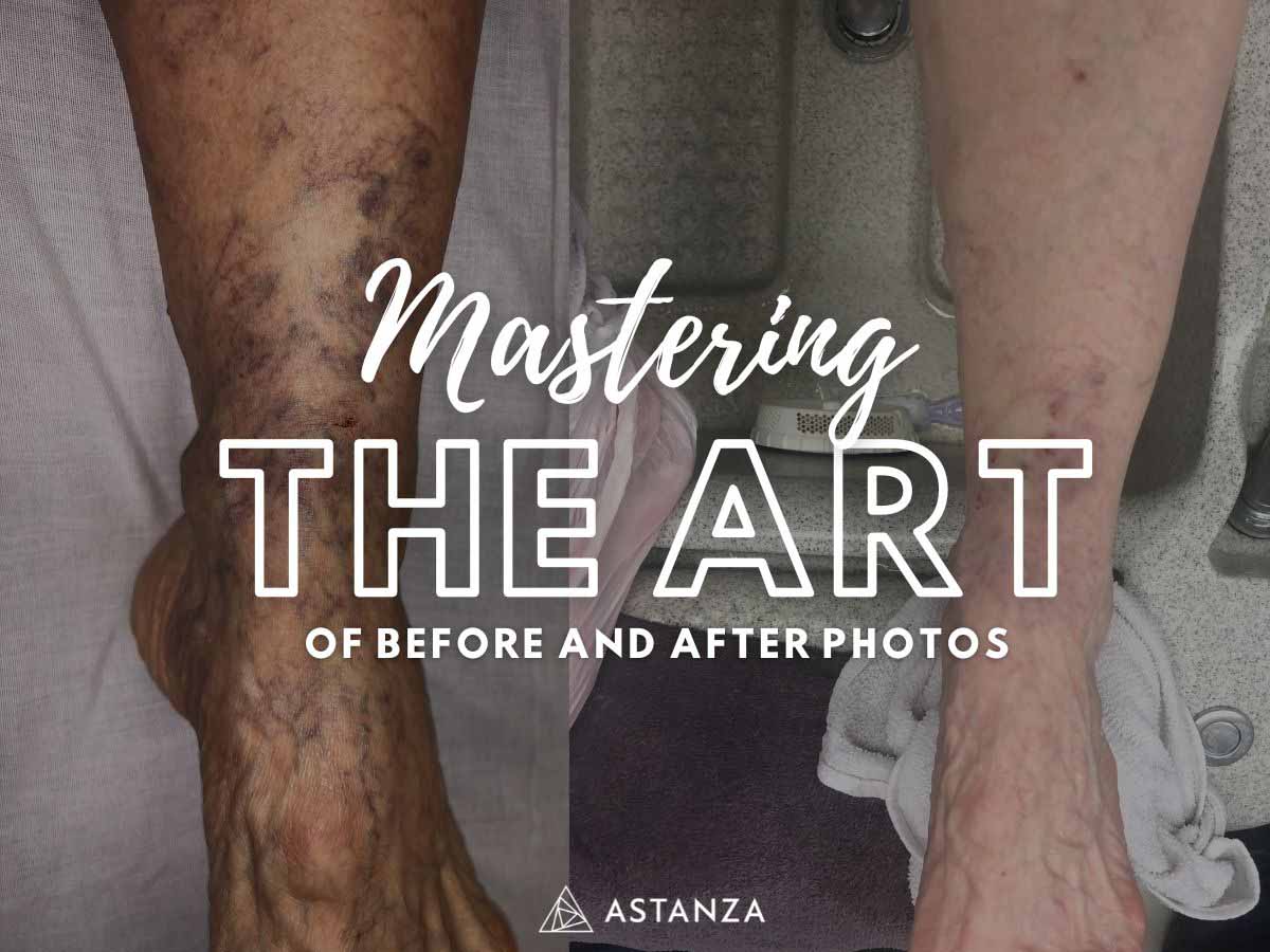 mastering the art of before and after photos