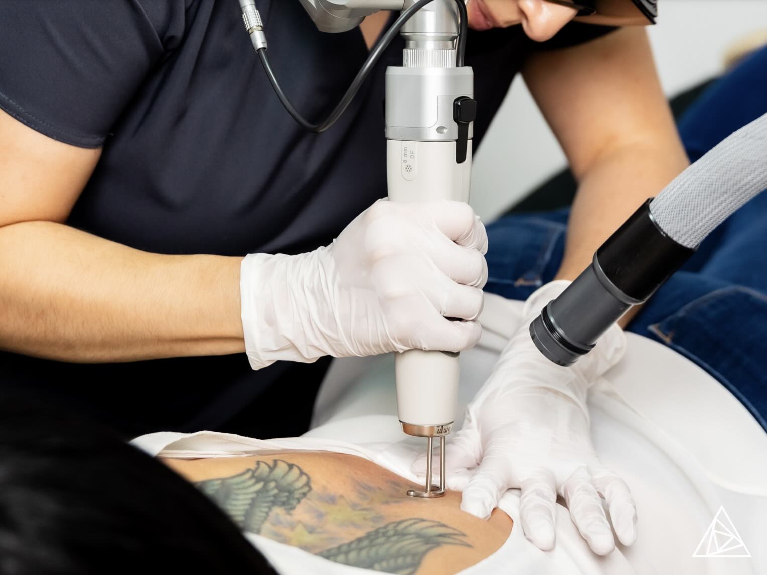 BLOG-Tattoo-Removal-in-Corrections-and-Reentry-A-Path-to-Rehabilitation