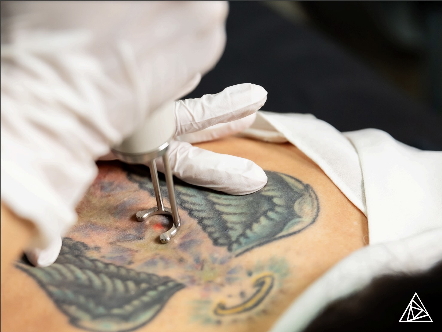 BLOG - Tax Savings on Your Tattoo Removal Machine