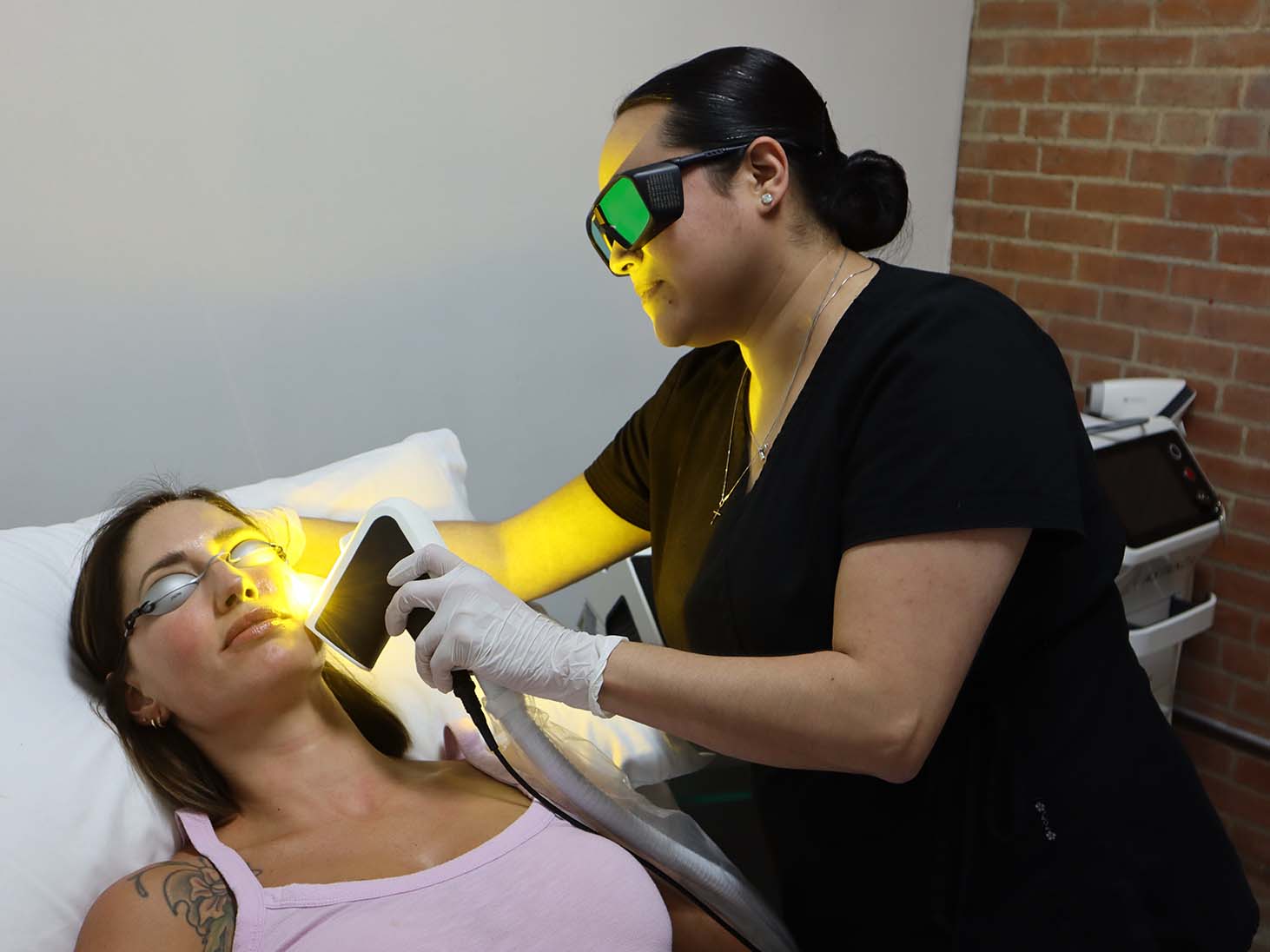 quadrostar skin resurfacing laser