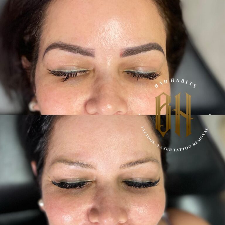 Bad Habits Eyebrow Before & After