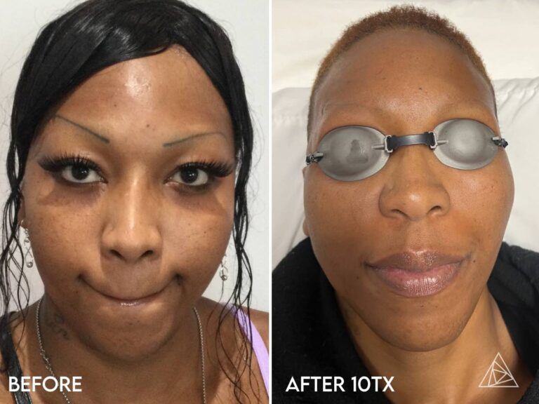 PMU Landing Page Before and After