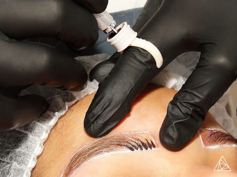BLOG - Eyebrow Tattoo Removal with Astanza Technology