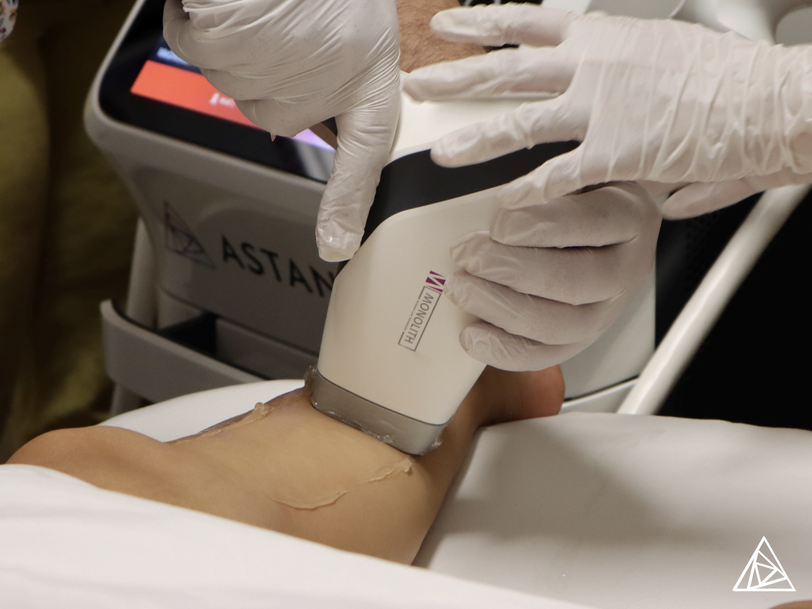 BLOG - Key Features of Diode Laser Hair Removal Machines