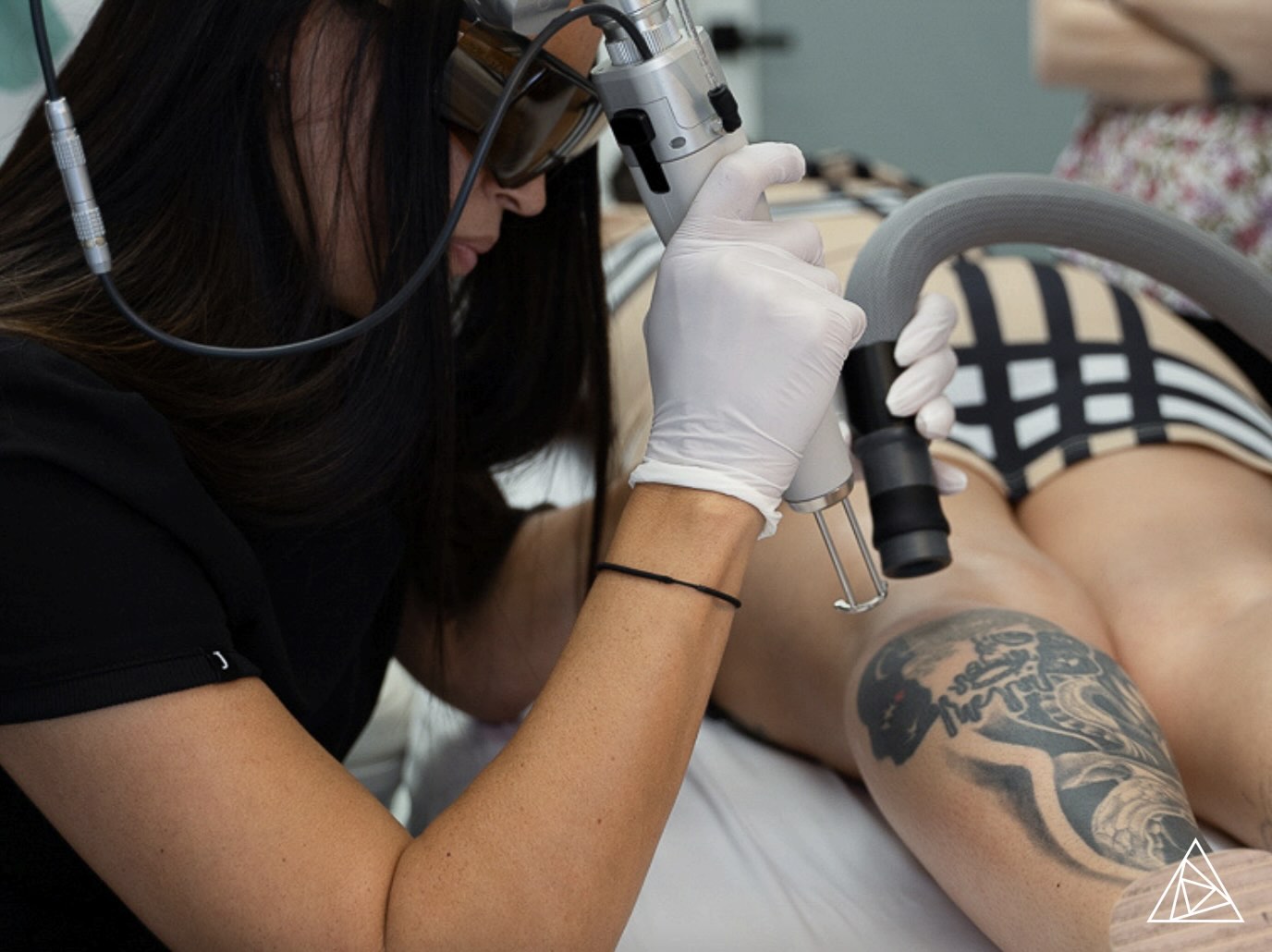 BLOG: Capitalize on the Growing Demand for Laser Tattoo Removal