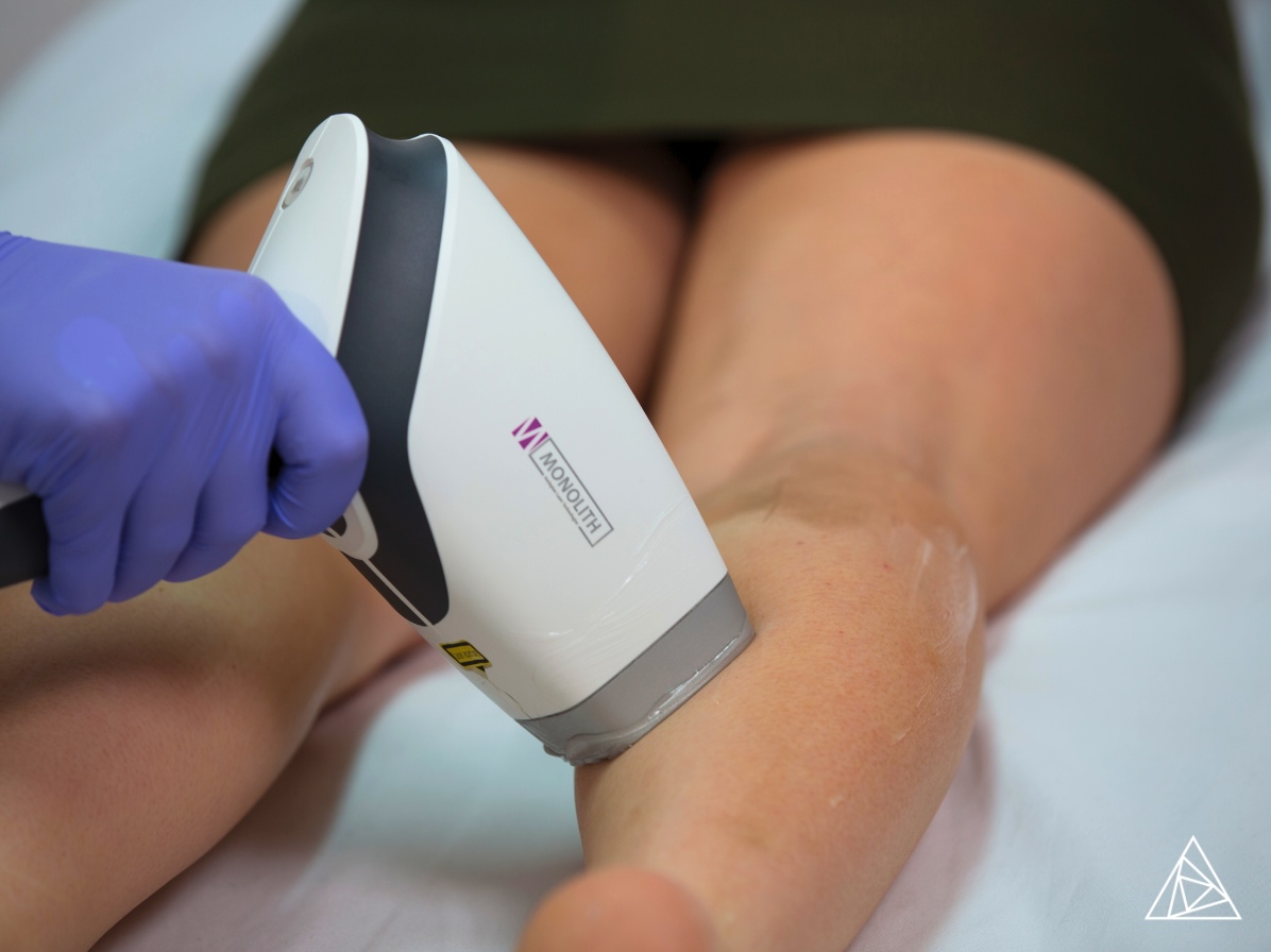 Science of Silky Smooth Diode Laser Hair Removal BLOG