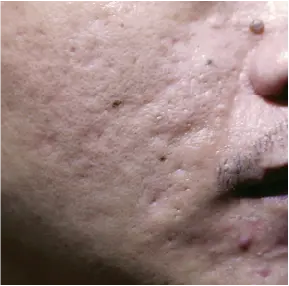 Before treatment