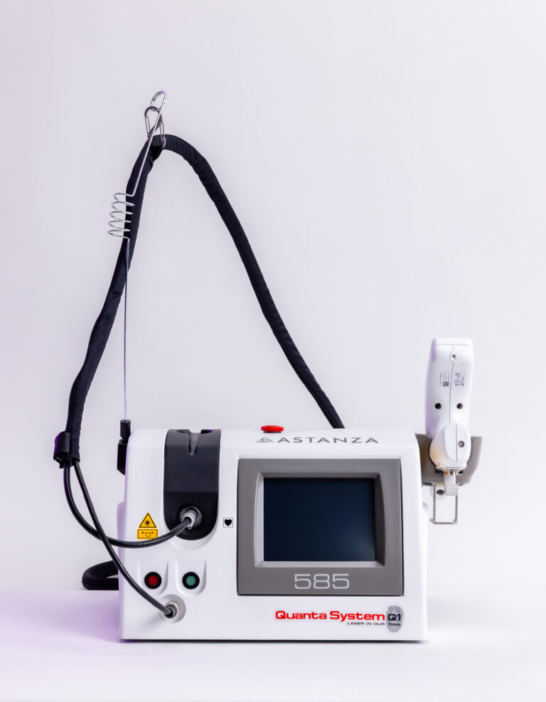 Quanta 585 laser for melasma and vascular treatments