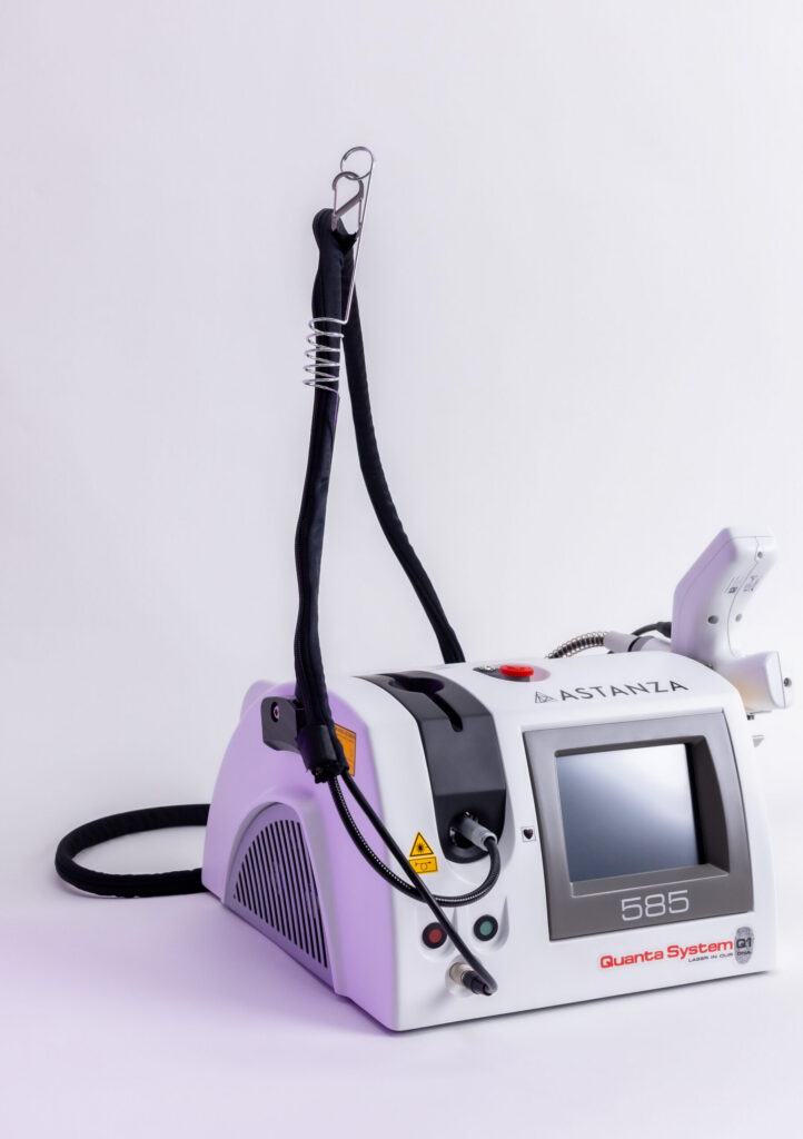 Quanta 585 laser for melasma and vascular treatments