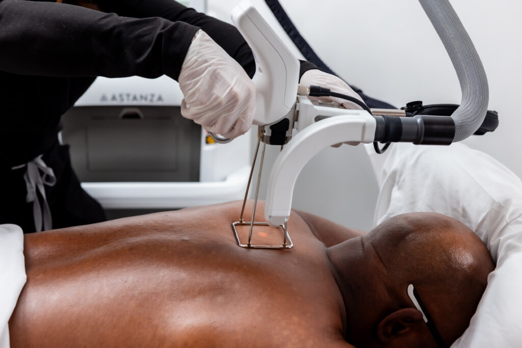 Laser Hair Removal for Men: A Revenue Opportunity for Clinics