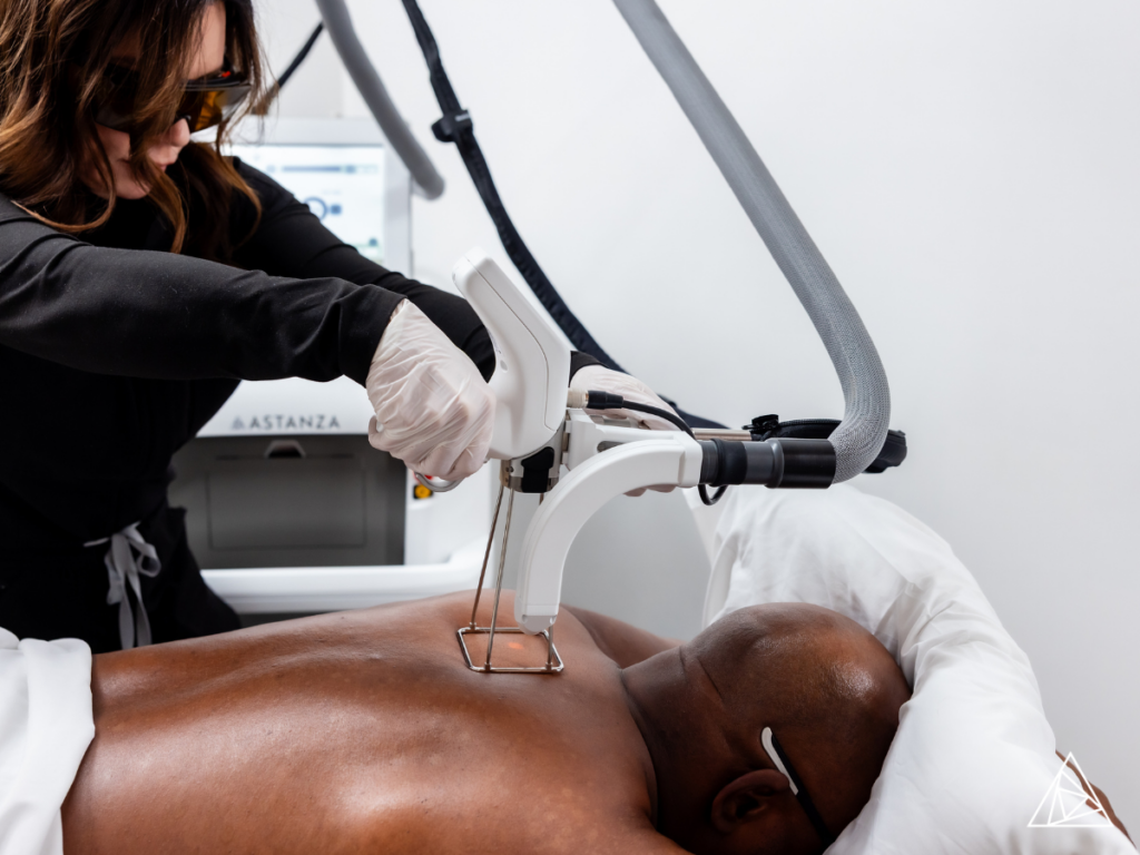 Why Clinics Choose the Thunder Series for Laser Hair Reduction