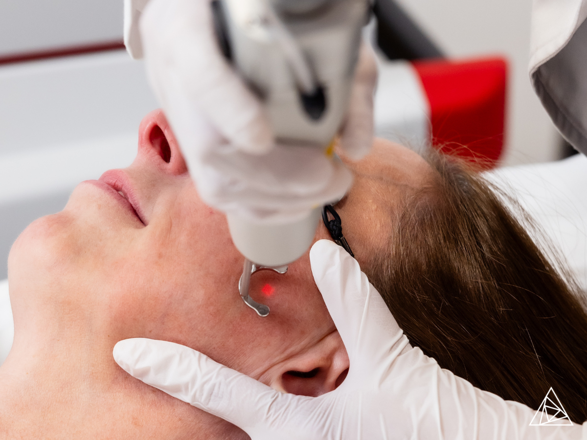 How Picosecond Lasers Address Sun Damage and Uneven Skin Tone