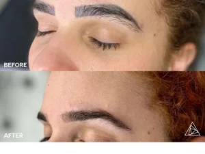 B&A Laser with Liz Webinar 2